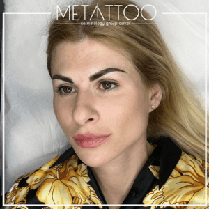 Metattoo